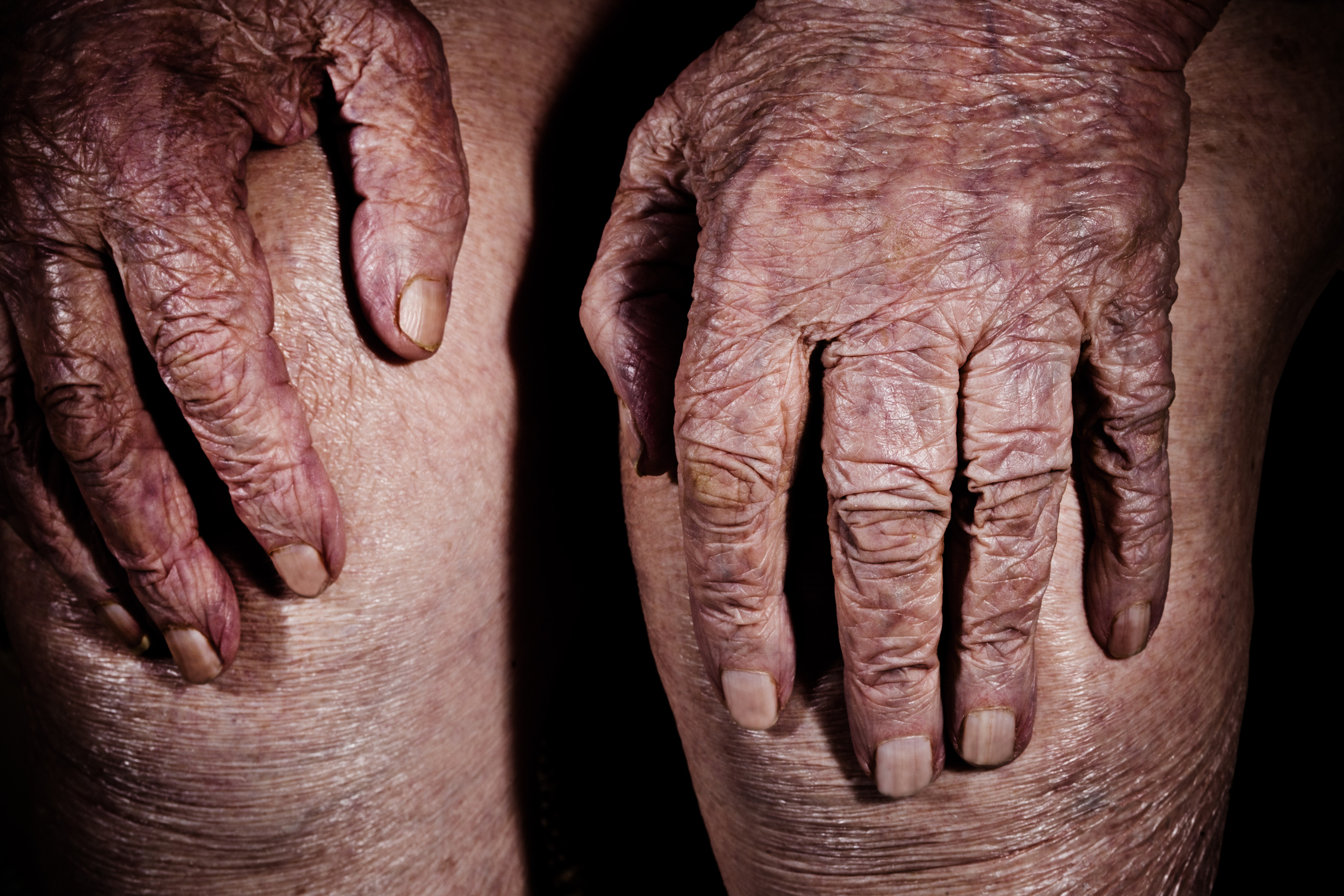 wrinkled aged hands
